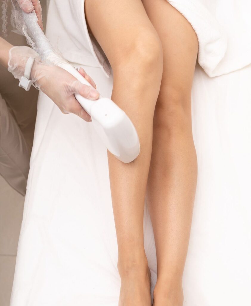 Laser hair removal features